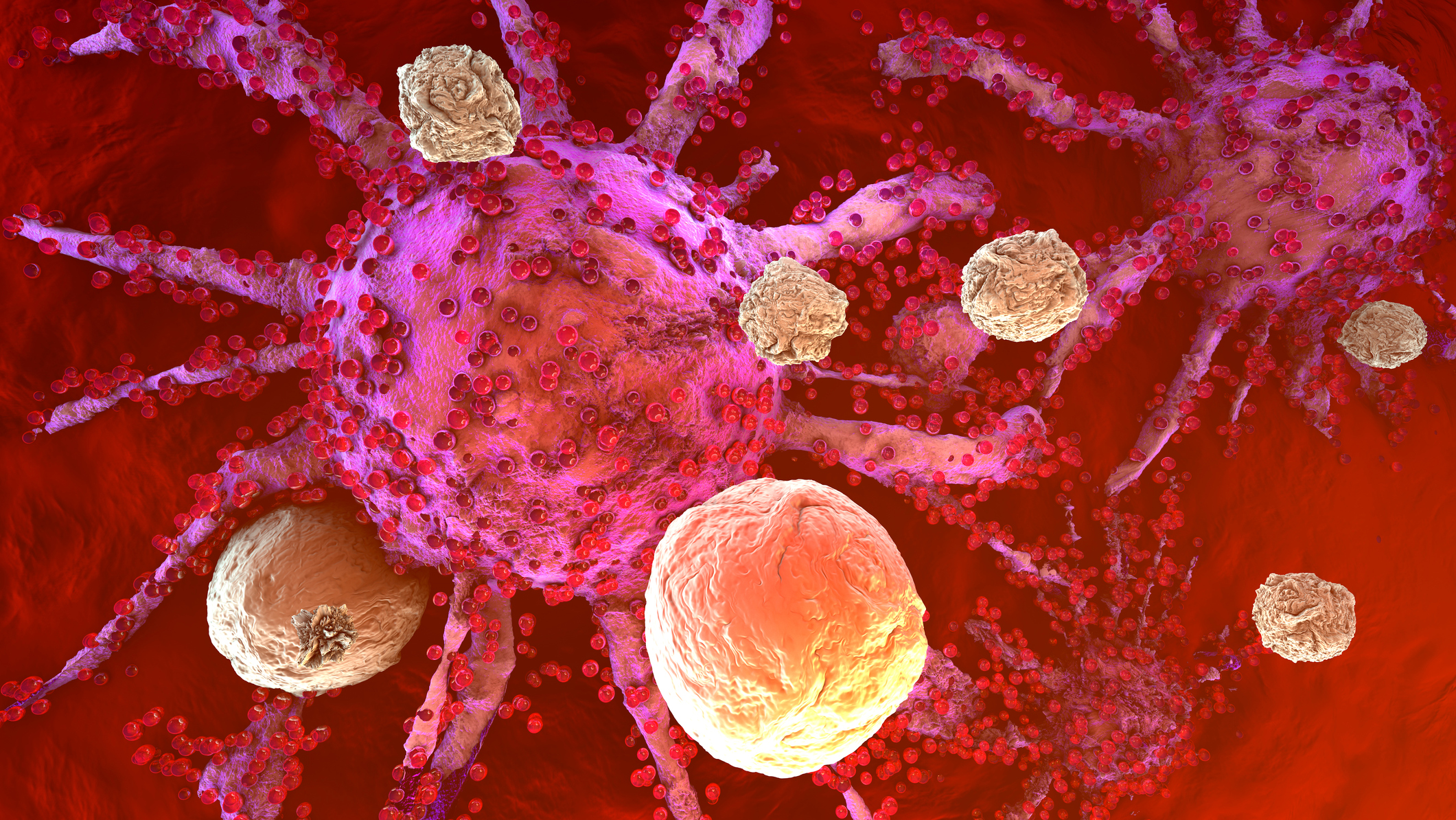 T Cells Attacking Cancer Cells